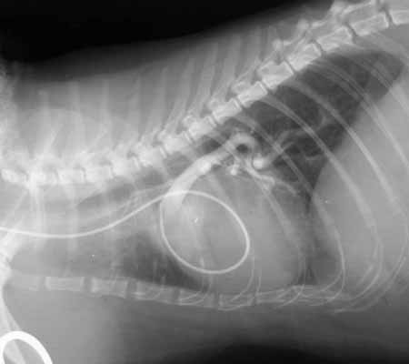 Angiogram obtained after injecting nonionic contrast agent from the catheter positioned in the pulmonary artery. The image shows an enlarged and very tortuous caudal lobar pulmonary artery branch.