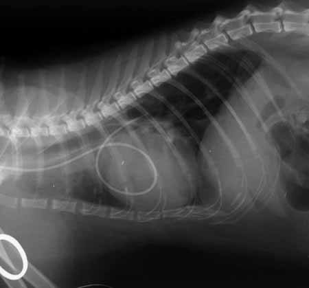 Fluoroscopic image showing the balloon wedge catheter advanced into the first position, consistent with the pulmonary artery.