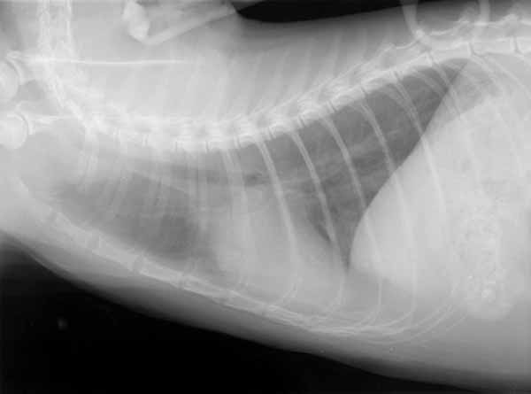 Right lateral thoracic radiograph taken 24 hours after medical therapy for pulmonary edema was instituted. The alveolar infiltrates seen at admission are no longer present. The lung fields are normal.