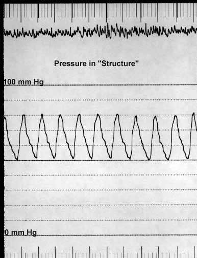 Pressure tracing recorded from within the ductus (structure S), showing systolic and diastolic pressures equal to those in the aorta and pulmonary artery.
