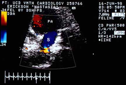 Color flow Doppler echocardiogram showing flow through the large structure (S) from the pulmonary artery (PA) into the aorta (AO). The flow is depicted in homogeneous blue, indicating laminar flow away from the transducer. At the aortic end, the color turns gold where flow velocity exceeds the Nyquist limit of 0.34 meters per second.
