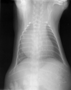Dorsoventral thoracic radiograph showing an abnormally shaped cardiac silhouette with enlargement of the right side of the heart.