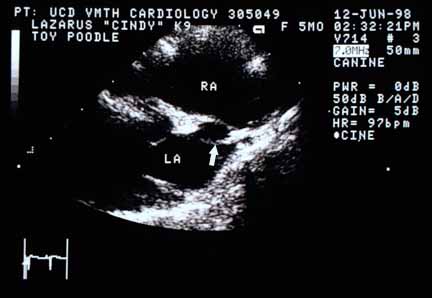 Echocardiographic view of the atrial septum from the right side of the dog. Two walls of the atrial septum are visible, separated by a hole indicated by an arrow.
