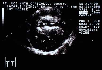 Cross-sectional echocardiographic view from the right parasternal position, again showing the severely thickened right ventricular free wall on top and the hyperechoic subendocardium.