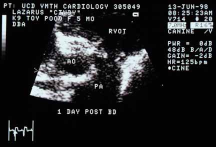 Echocardiogram of the pulmonic valve taken the day after balloon valvuloplasty. Unlike the pre-intervention image, a readily demonstrable orifice is now visible. RVOT — right ventricular outflow tract; PA — pulmonary artery; AO — aorta.