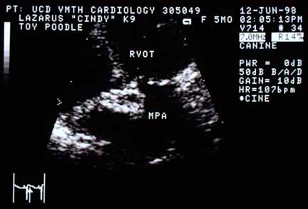 Echocardiographic view of the pulmonic valve between the right ventricular outflow tract (RVOT) and the main pulmonary artery (MPA). The valve cusps appear thicker than normal. This systolic frame shows the cusps are immobile and have not opened.