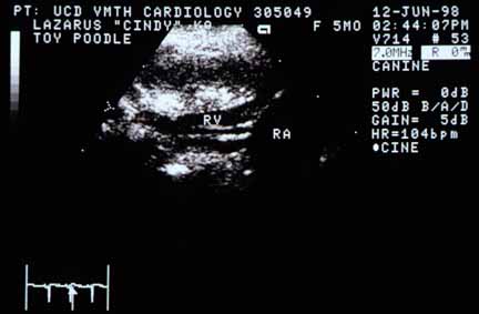 Echocardiographic view of the tricuspid valve showing long and thickened chordae tendineae immediately below the RV label. RA — right atrium.