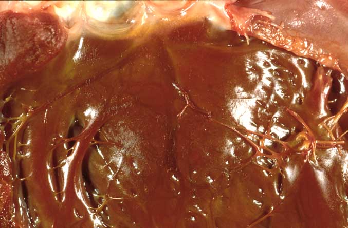 Left bundle branch stained with iodine in a post mortem canine left ventricle specimen